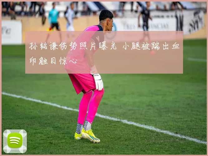孙铭谦伤势照片曝光 小腿被踹出血印触目惊心